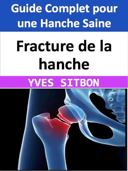 Title details for Fracture de la hanche by YVES SITBON - Available